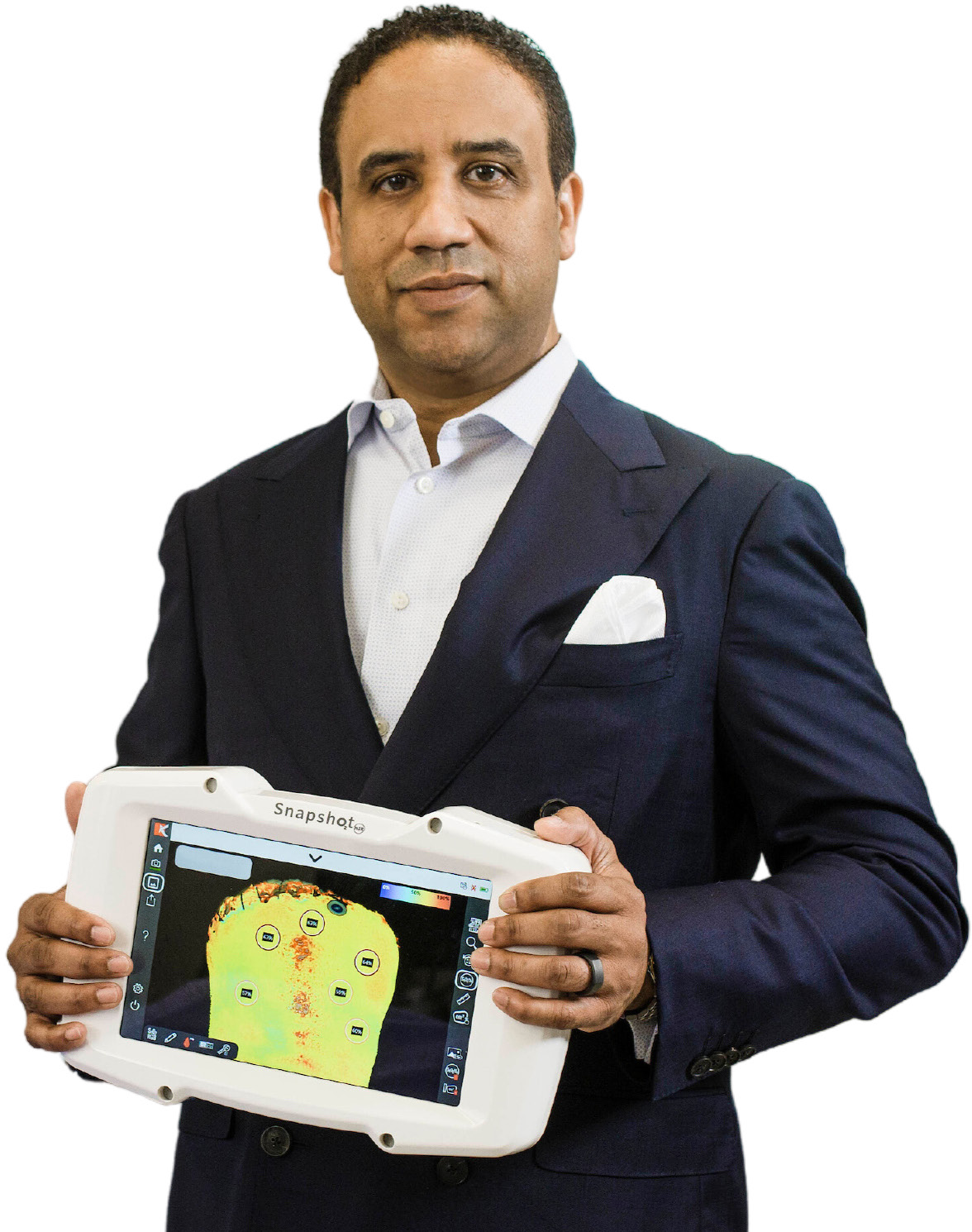 Dr. Alonso holding a near-infrared imaging camera showing tissue oxygenation in a foot