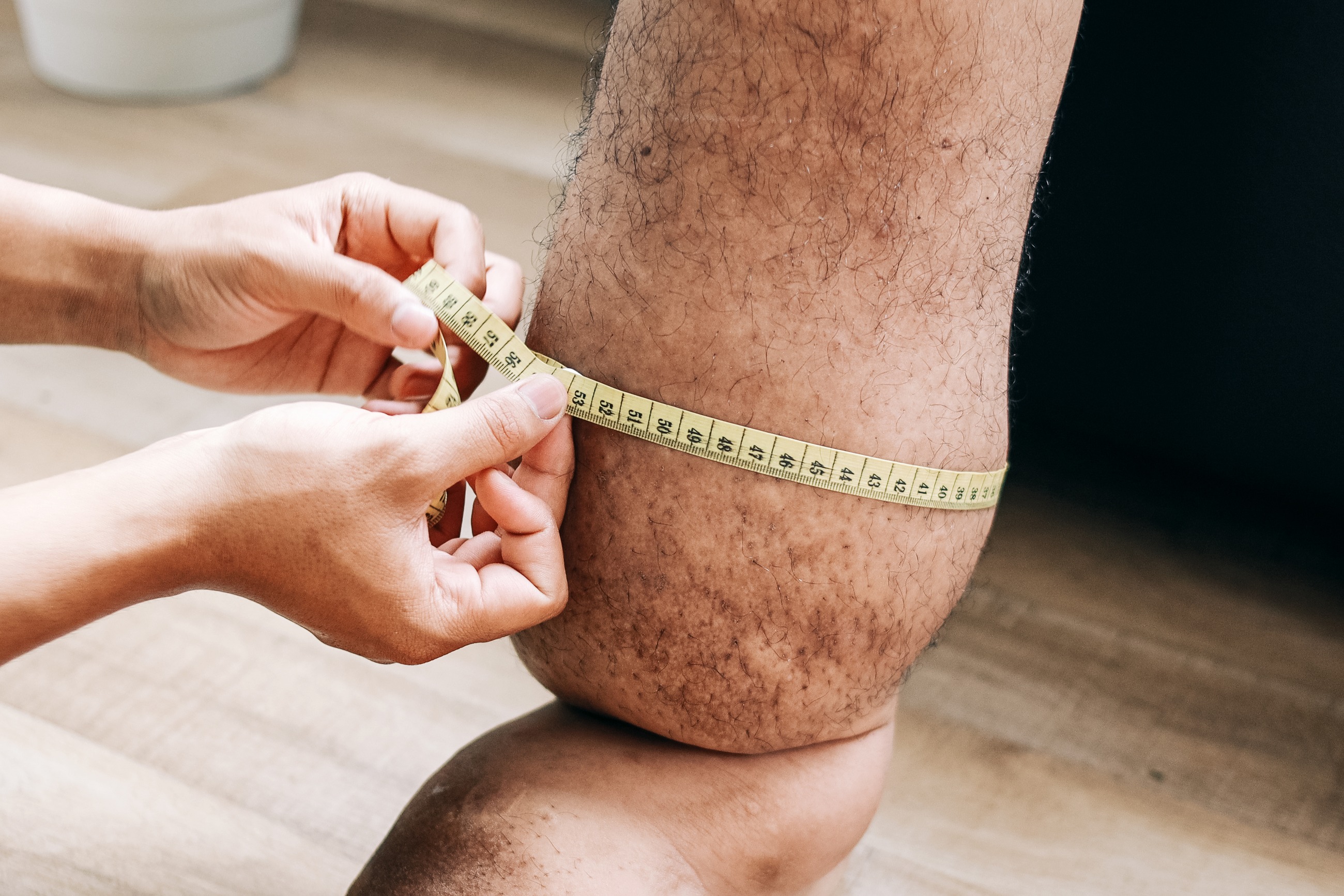 Measuring limb circumference to track swelling between visits